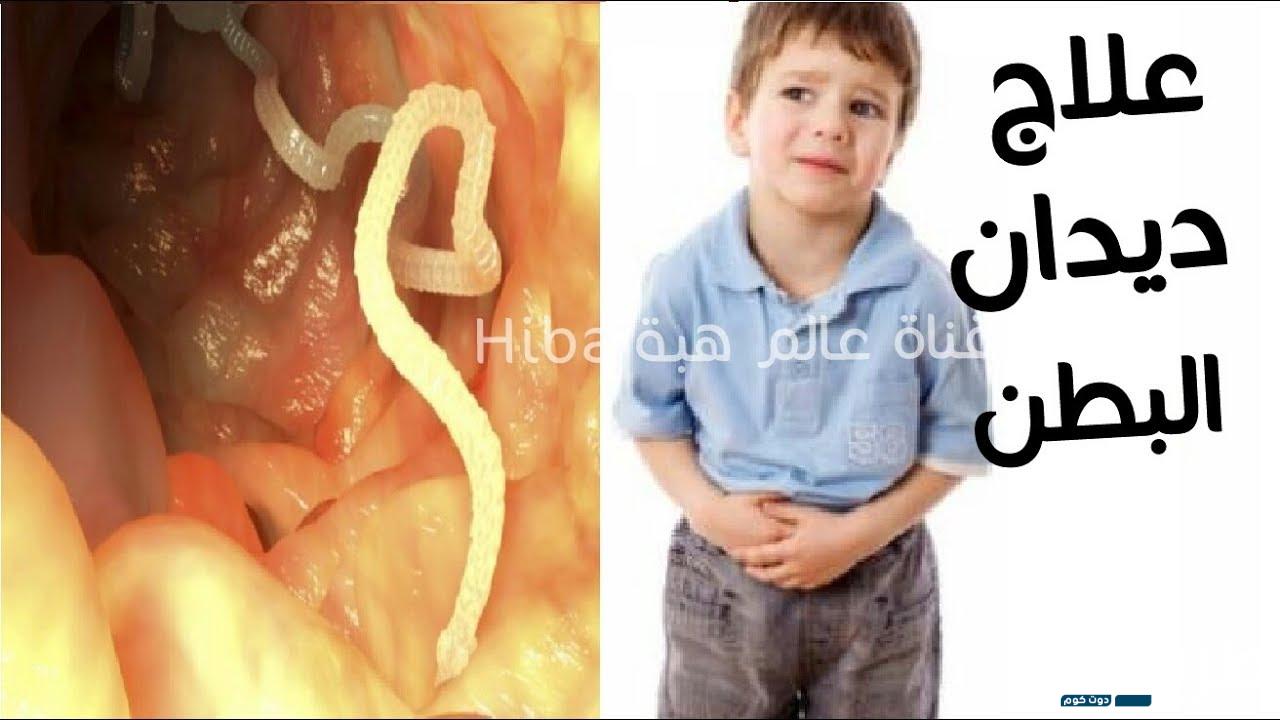 تجربتي في علاج الديدان عند الأطفال بوصفات طبيعية 5 277817655850266